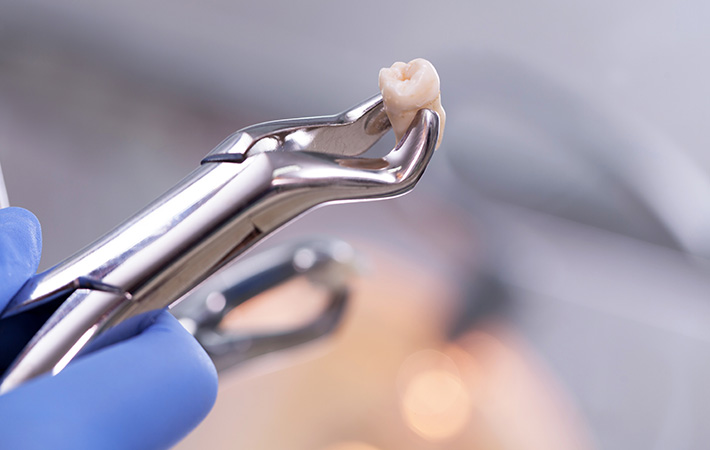 デンタルリフレクソロジー