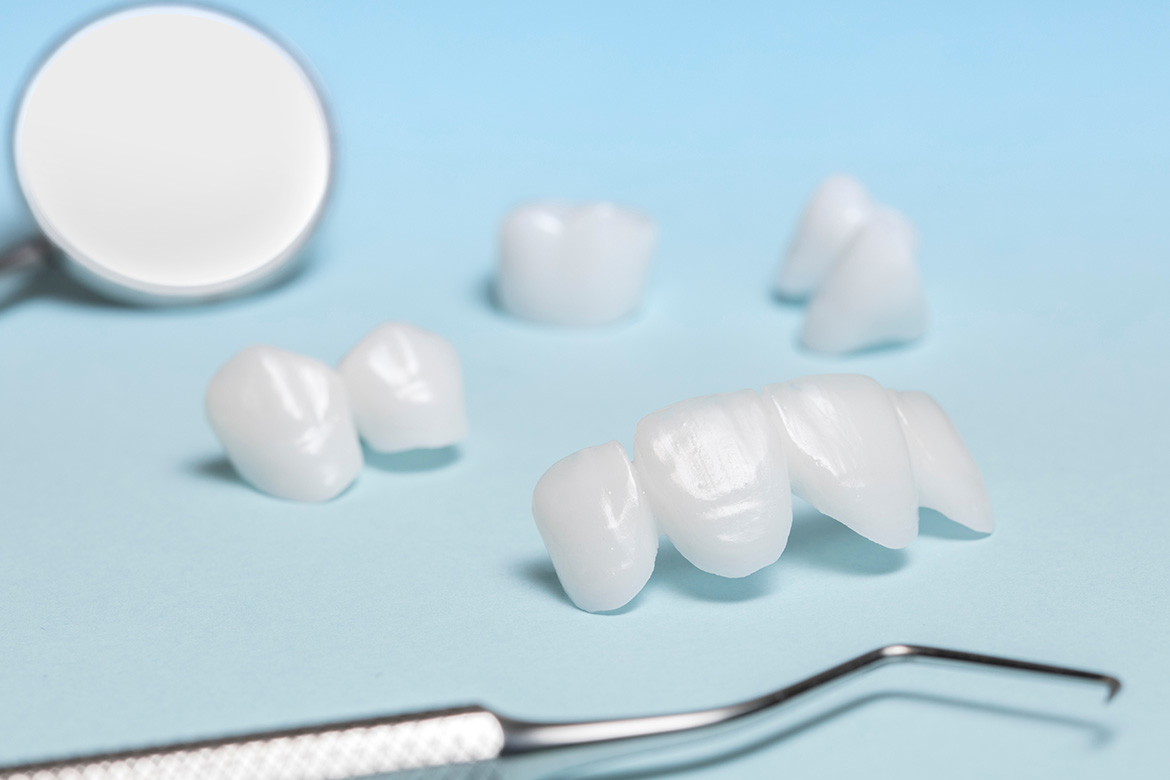 審美補綴（セラミック治療）