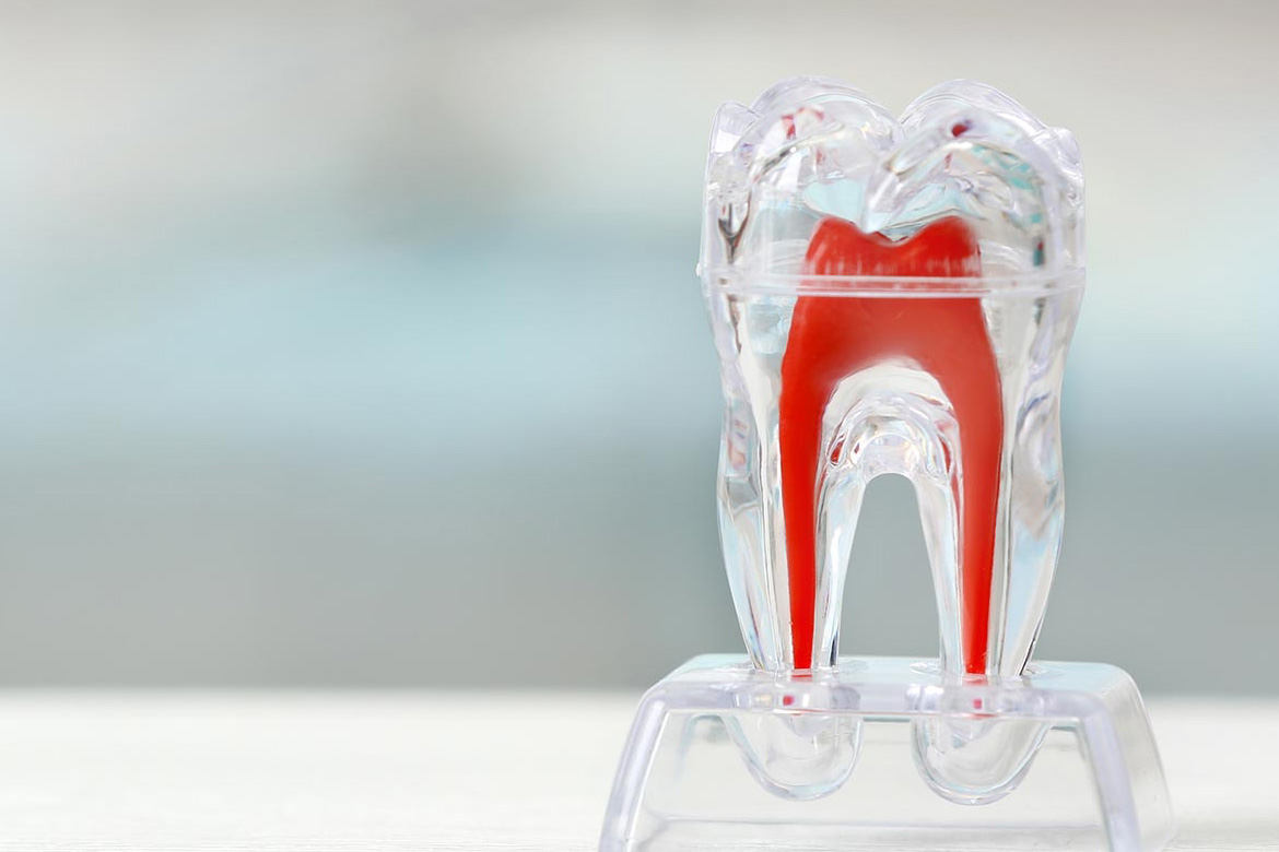 マイクロスコープを活用したむし歯治療