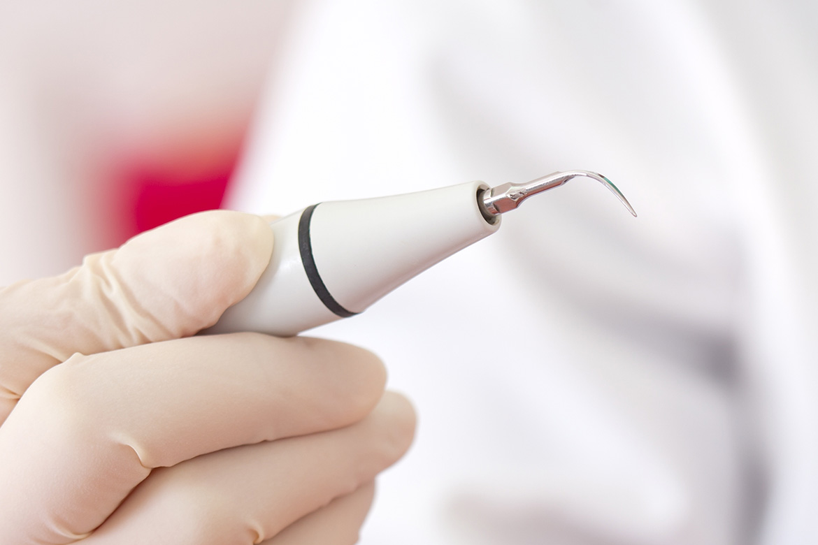 超音波スケーラー