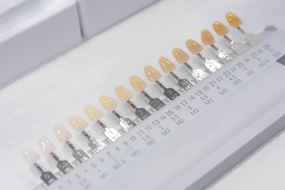 オフィスホワイトニング