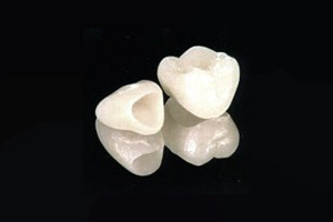 オールセラミック(e-max)